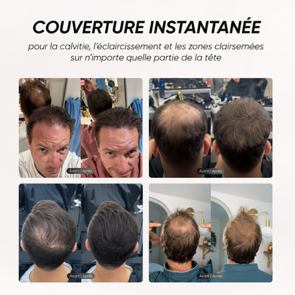 Camouflage capillaire