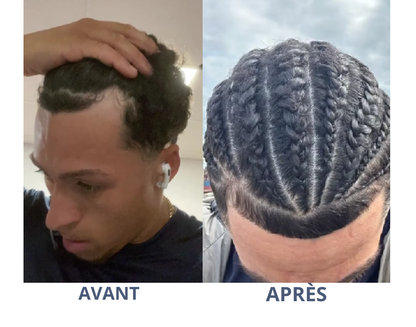 root roll-on
