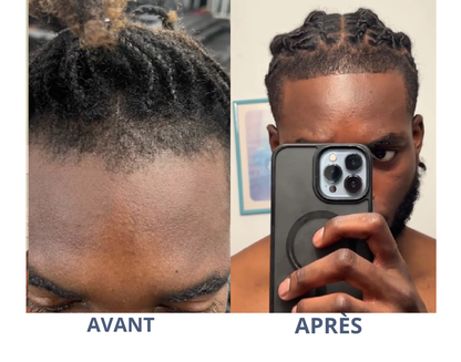 root roll-on